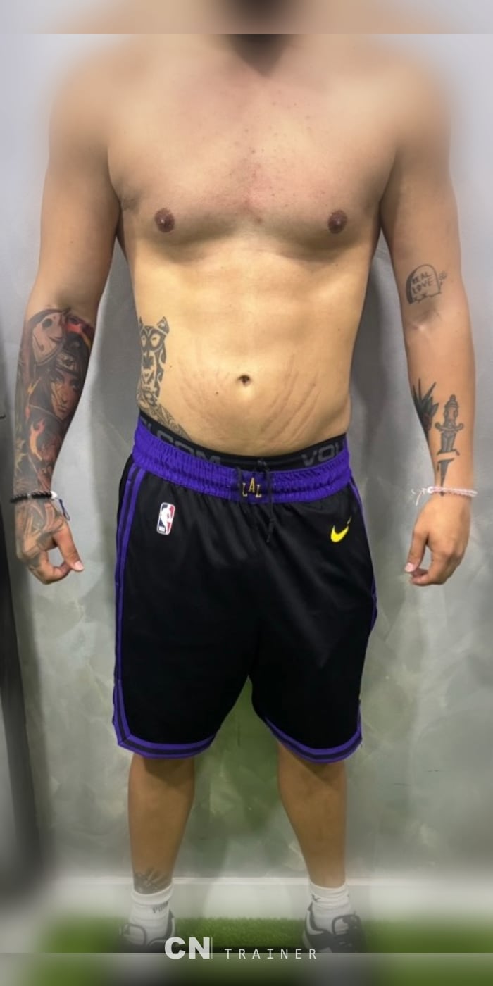 Después del proceso con CN Trainer